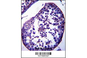 Image no. 2 for anti-Spermatogenesis Associated 18 (SPATA18) (AA 92-120), (N-Term) antibody (ABIN657881)