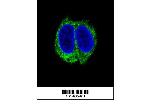 Image no. 1 for anti-Transforming Growth Factor, beta Receptor II (70/80kDa) (TGFBR2) (AA 13-40), (N-Term) antibody (ABIN655799)