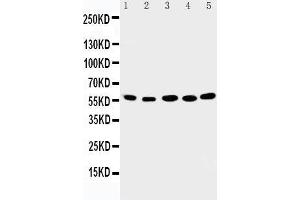 Image no. 1 for anti-Abl-Interactor 2 (ABI2) (AA 158-173), (N-Term) antibody (ABIN3042919)