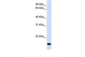 Image no. 1 for anti-Ring Finger Protein 185 (RNF185) (AA 74-123) antibody (ABIN6738076)