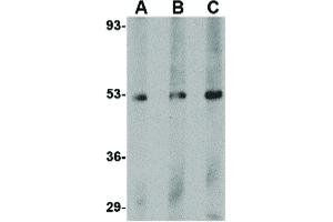 Image no. 1 for anti-Plexin Domain Containing 1 (PLXDC1) (C-Term) antibody (ABIN6656324)