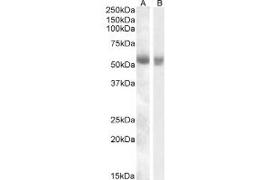 anti-Transmembrane Protease, serine 2 (TMPRSS2) (Internal Region) antibody