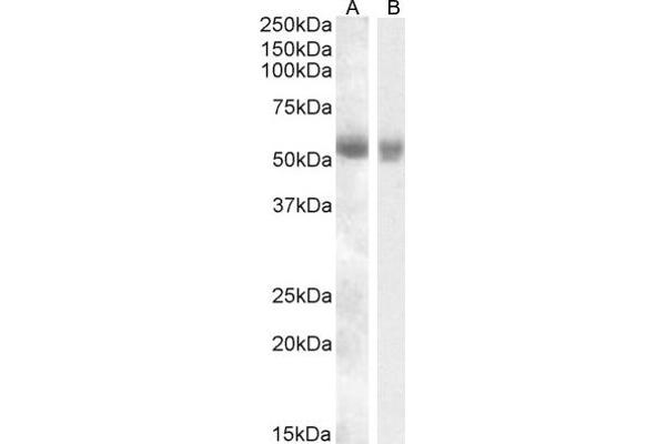 anti-Transmembrane Protease, serine 2 (TMPRSS2) (Internal Region) antibody