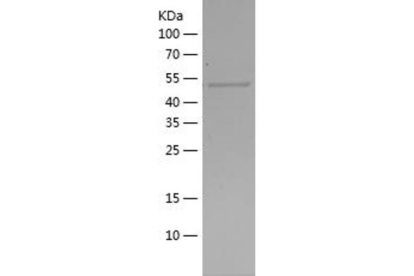 SOCS3 Protein (AA 1-225) (His-IF2DI Tag)