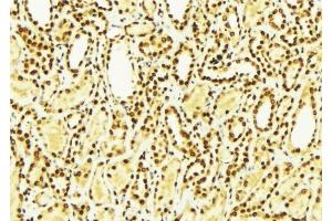 Image no. 2 for anti-Chloride Intracellular Channel 4 (CLIC4) (N-Term) antibody (ABIN6257066)