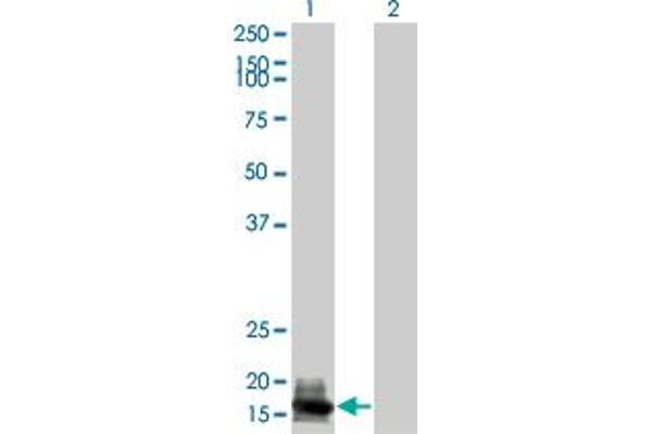 GCAP1 anticorps  (AA 1-93)