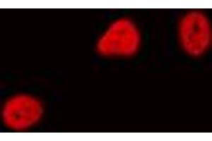Image no. 1 for anti-Cell Division Cycle Associated 4 (CDCA4) (Center) antibody (ABIN2972927)