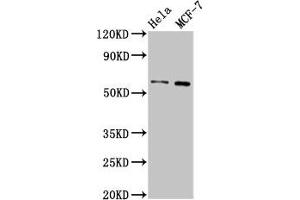 MMP28 抗体  (AA 351-475)