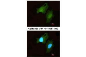 Image no. 3 for anti-DIP2 Disco-Interacting Protein 2 Homolog B (DIP2B) (C-Term) antibody (ABIN2856736)