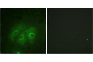 Immunofluorescence analysis of HeLa cells, using p47 phox (Phospho-Ser359) Antibody.
