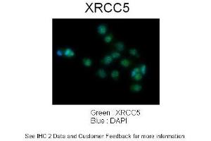 Image no. 4 for anti-X-Ray Repair Complementing Defective Repair in Chinese Hamster Cells 5 (Double-Strand-Break Rejoining) (XRCC5) (C-Term) antibody (ABIN2778271)