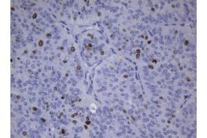 Image no. 4 for anti-Antigen Identified By Monoclonal Antibody Ki-67 (MKI67) (AA 1160-1493) antibody (ABIN1490856)