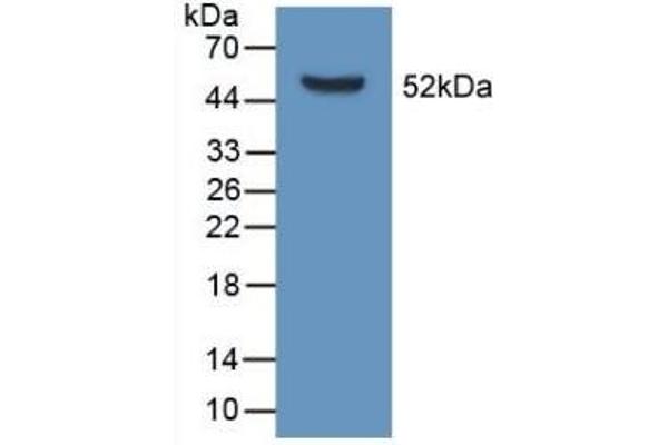 Apolipoprotein D Antikörper  (AA 1-189)