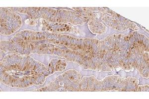 Image no. 2 for anti-Autophagy Related 13 (ATG13) (pSer355) antibody (ABIN6255252)