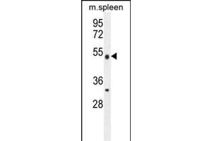 Image no. 2 for anti-Methyltransferase Like 4 (METTL4) (AA 315-344), (C-Term) antibody (ABIN5538187)