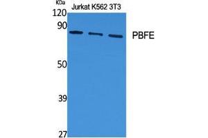 Image no. 2 for anti-Enoyl-CoA, Hydratase/3-Hydroxyacyl CoA Dehydrogenase (EHHADH) (Internal Region) antibody (ABIN3186348)