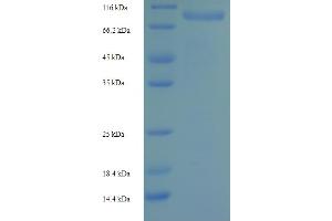 Image no. 1 for Ribonucleotide Reductase M1 (RRM1) (AA 1-792), (full length) protein (His-SUMO Tag) (ABIN5710282)