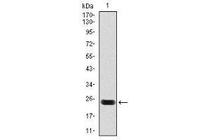 Image no. 2 for anti-Troponin T2, Cardiac (TNNT2) antibody (ABIN1497102)