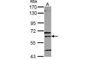 ALAS2 antibody  (Center)
