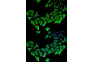 Image no. 1 for anti-Amyloid beta (A4) Precursor-Like Protein 1 (APLP1) antibody (ABIN6136993)