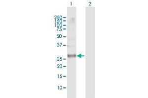 Image no. 5 for anti-Cyclin-Dependent Kinase 20 (CDK20) (AA 1-275) antibody (ABIN525247)