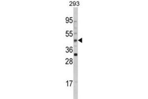 Image no. 3 for anti-Arylacetamide Deacetylase (Esterase) (AADAC) antibody (ABIN3002812)