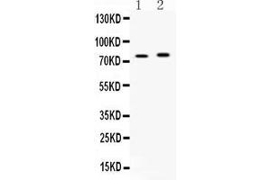 Image no. 1 for anti-Acyl-CoA Synthetase Long-Chain Family Member 5 (ACSL5) (AA 337-378), (Middle Region) antibody (ABIN5518721)