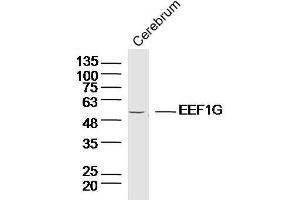 Image no. 2 for anti-Eukaryotic Translation Elongation Factor 1 gamma (EEF1G) antibody (ABIN1714736)