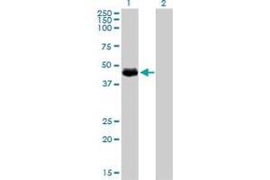 Image no. 2 for anti-Transforming Growth Factor beta 1 Induced Transcript 1 (TGFB1I1) (AA 1-444) antibody (ABIN563174)