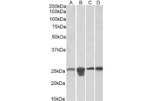 Image no. 3 for anti-Superoxide Dismutase 2, Mitochondrial (SOD2) (AA 119-130) antibody (ABIN768566)