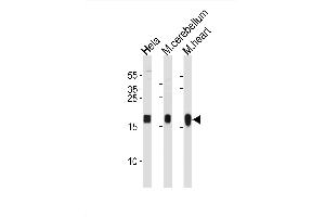 Image no. 1 for anti-NADH Dehydrogenase (Ubiquinone) Fe-S Protein 7, 20kDa (NADH-Coenzyme Q Reductase) (NDUFS7) (AA 119-146) antibody (ABIN1881572)