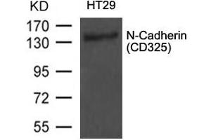 Image no. 1 for anti-Cadherin 2 (CDH2) (AA 800-804) antibody (ABIN6267736)