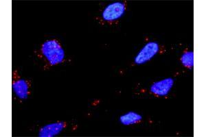 Image no. 4 for anti-Hepatocyte Growth Factor (Hepapoietin A, Scatter Factor) (HGF) (AA 1-728) antibody (ABIN516424)