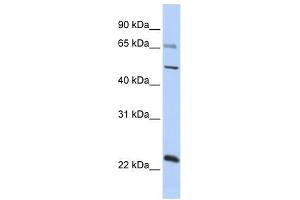 Image no. 1 for anti-Zinc Finger Protein 597 (ZNF597) (Middle Region) antibody (ABIN927587)