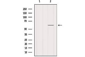 Image no. 3 for anti-Glypican 5 (GPC5) antibody (ABIN6257249)