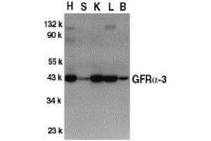 Image no. 2 for anti-GDNF Family Receptor alpha 3 (GFRA3) (Intermediate Domain) antibody (ABIN499887)
