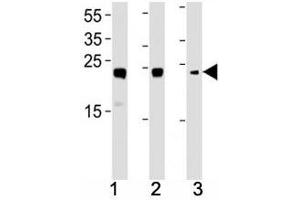 Image no. 1 for anti-High Mobility Group Box 2 (HMGB2) (AA 92-118) antibody (ABIN3031202)