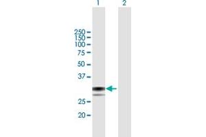 Image no. 1 for anti-SplA/ryanodine Receptor Domain and SOCS Box Containing 1 (SPSB1) (AA 1-273) antibody (ABIN949668)