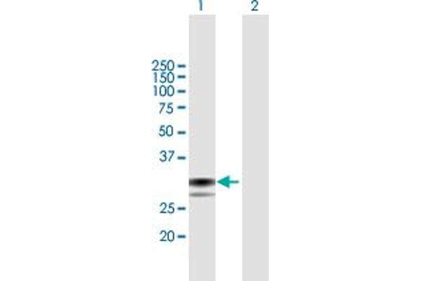anti-SplA/ryanodine Receptor Domain and SOCS Box Containing 1 (SPSB1) (AA 1-273) antibody