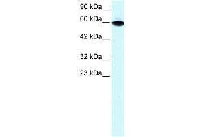 Image no. 1 for anti-Zinc Finger and BTB Domain Containing 7B (ZBTB7B) (Middle Region) antibody (ABIN2777563)