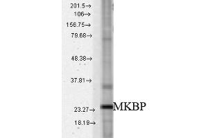 Image no. 2 for anti-Heat Shock 27kDa Protein 2 (HSPB2) antibody (FITC) (ABIN2486041)