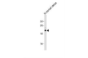 Image no. 4 for anti-Caveolin 3 (CAV3) (AA 5-31), (N-Term) antibody (ABIN390412)