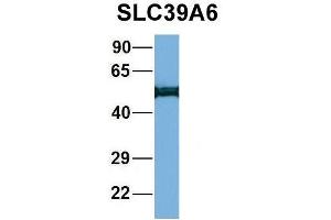Image no. 5 for anti-Solute Carrier Family 39 (Zinc Transporter), Member 6 (SLC39A6) (Middle Region) antibody (ABIN2781630)