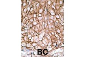 Image no. 3 for anti-Pancreatic and Duodenal Homeobox 1 (PDX1) (AA 429-459), (C-Term) antibody (ABIN388773)