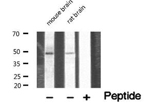 Image no. 3 for anti-Neurogenic Differentiation 2 (NEUROD2) antibody (ABIN6263551)