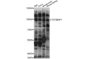 Image no. 1 for anti-Transforming Growth Factor, beta Receptor Associated Protein 1 (TGFBRAP1) antibody (ABIN6292312)