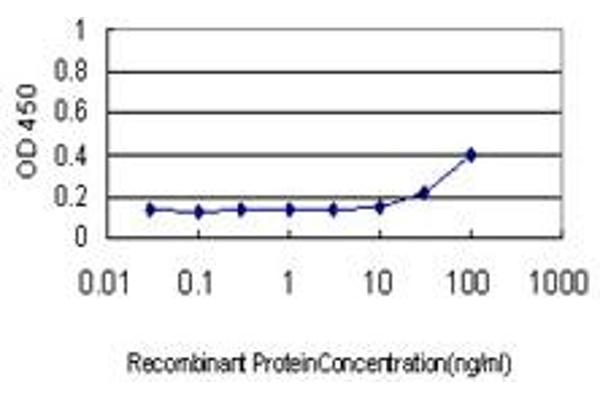 anti-S100 Calcium Binding Protein A7 (S100A7) (AA 1-101) antibody