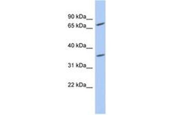 PPAPDC2 Antikörper  (AA 71-120)