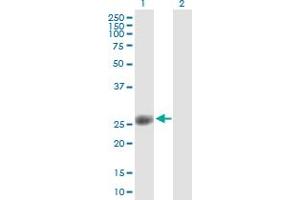 Image no. 5 for anti-Origin Recognition Complex, Subunit 6 (ORC6) (AA 1-252) antibody (ABIN525288)