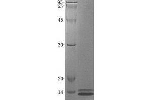 Image no. 1 for serine Peptidase Inhibitor, Kazal Type 1 (SPINK1) protein (ABIN2732592)